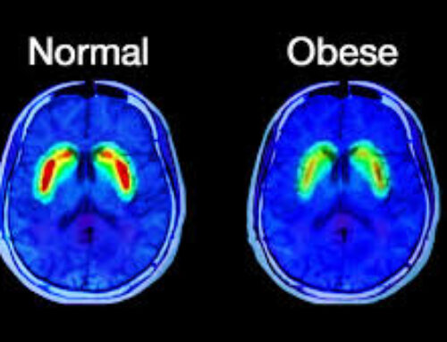 Yale study finds high-fat diet leads to neurological changes in brain