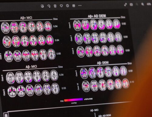 Blood tests for Alzheimer’s may be coming to your doctor’s office. Here are 4 things to know